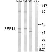 PRPF18 antibody