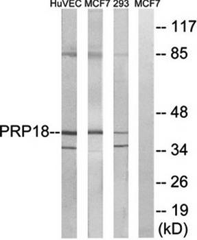 PRPF18 Antibody