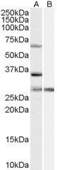 Goat anti-PRPF31 Antibody