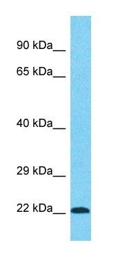 PRPF38B antibody