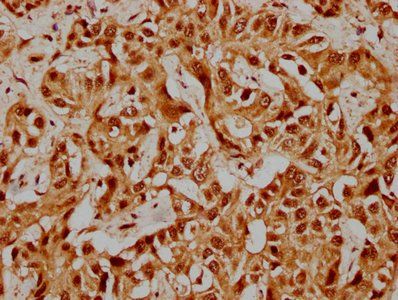 PRPF39 Antibody