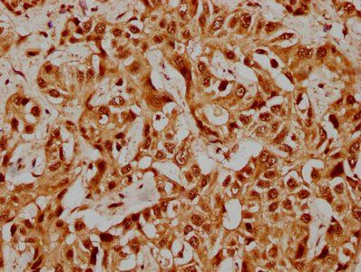 PRPF39 antibody