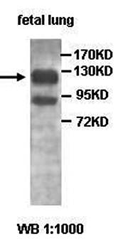PRPF4B antibody