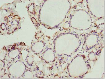 PRPH Antibody