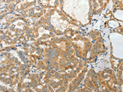 PRPH Antibody