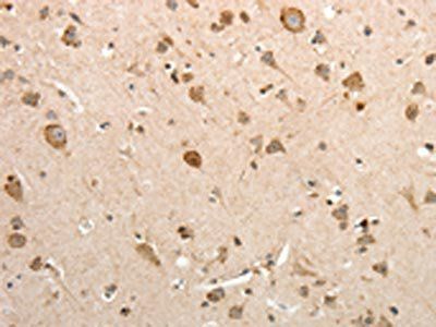 PRPH Antibody