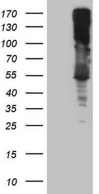 PRPK (TP53RK) antibody