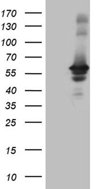 PRPK (TP53RK) antibody