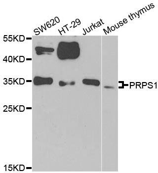 PRPS1 antibody