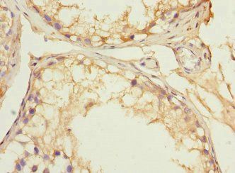 PRPS1 Antibody