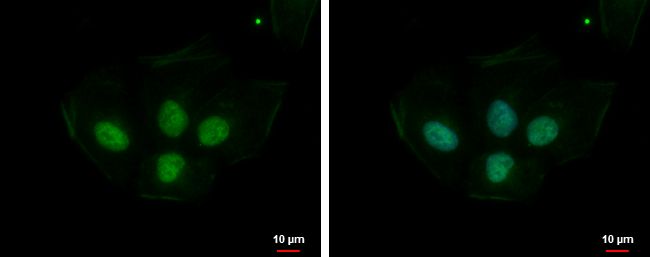 phosphoribosyl pyrophosphate synthetase 1 like 1 Antibody