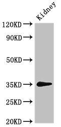 PRPS2 Antibody