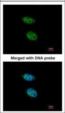 PRPS2 antibody [N1C3]