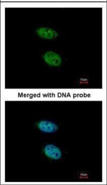 PRPS2 antibody