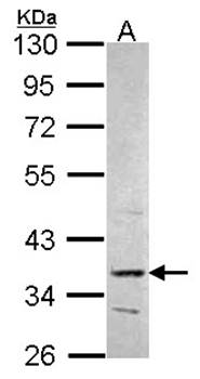PRPS2 antibody