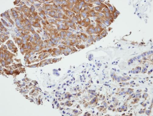 PRPSAP2 Rabbit Polyclonal Antibody