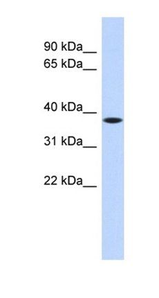 PRR14L antibody