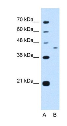 PRRC2B antibody