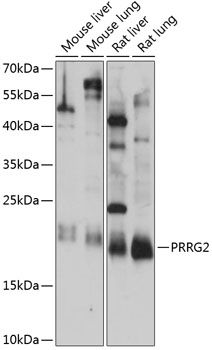 PRRG2 antibody