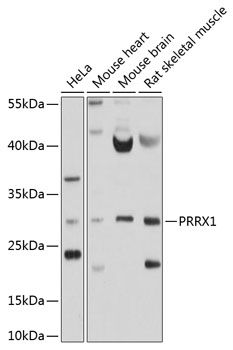 PRRX1 antibody