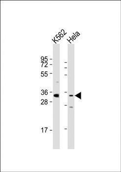 PRSS21 antibody