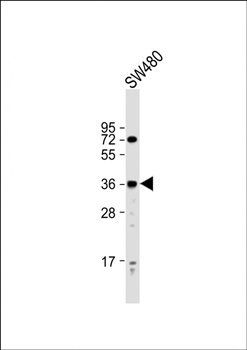 PRSS23 antibody