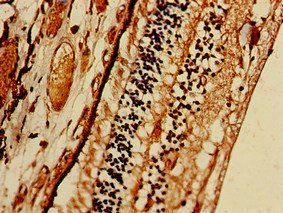 PRSS56 Antibody