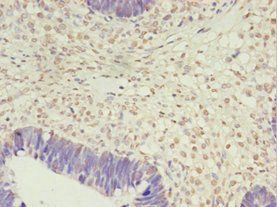 PRTFDC1 Antibody