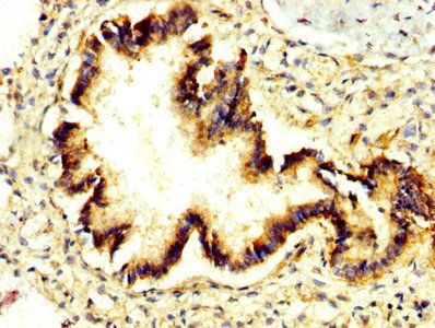 PRUNE1 Antibody