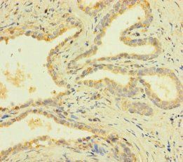 PRY Antibody