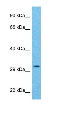 PSA7L antibody