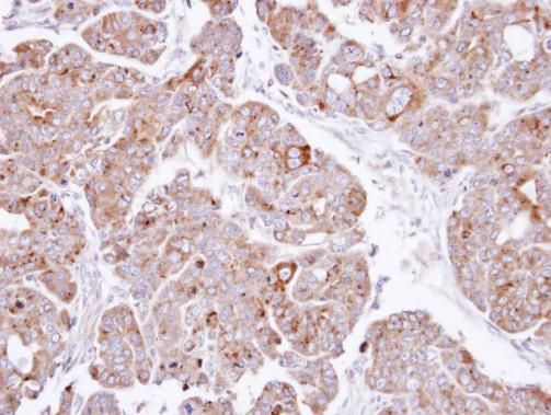 PSAP antibody [N1N3]