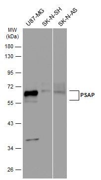PSAP Rabbit Polyclonal Antibody