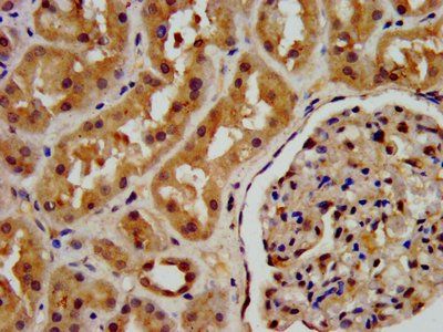 PSAT1 Antibody