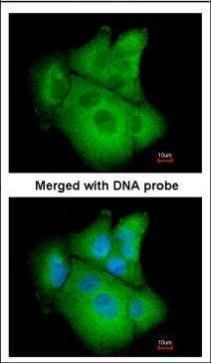 PSAT1 antibody [N1C3]