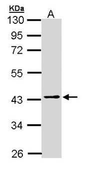 PSAT1 antibody