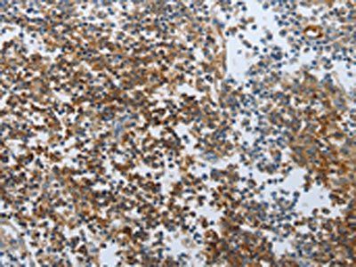 PSCA Antibody