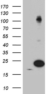 PSCD4 (CYTH4) antibody