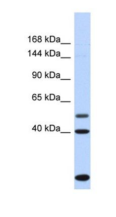 PSD3 antibody