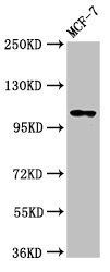 PSD antibody