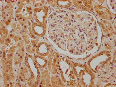 PSENEN Antibody