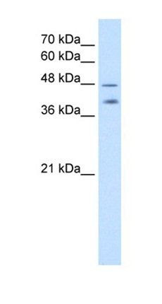PSG1 antibody