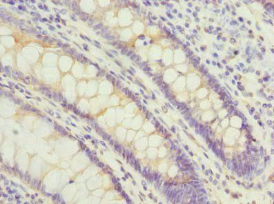 PSG3 Antibody
