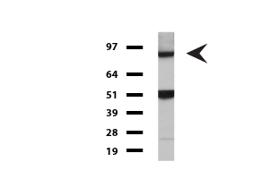 PSMA (FOLH1) antibody
