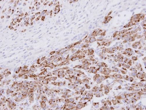 PSMA3 Rabbit Polyclonal Antibody