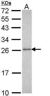 PSMA3 Rabbit Polyclonal Antibody