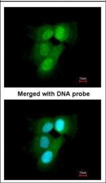 PSMA6 antibody