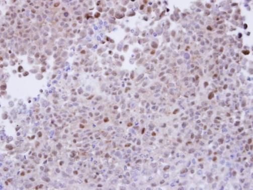 PSMA7 antibody [N1C3]