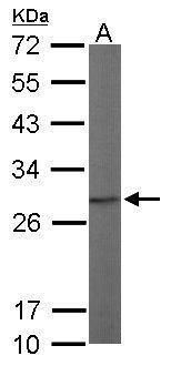 PSMA7 Rabbit Polyclonal Antibody