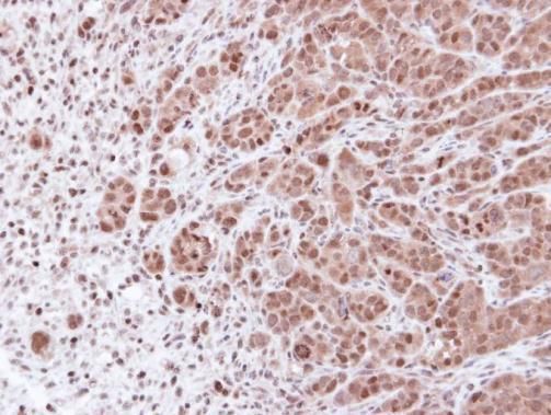 PSMA7 antibody [N1C2]